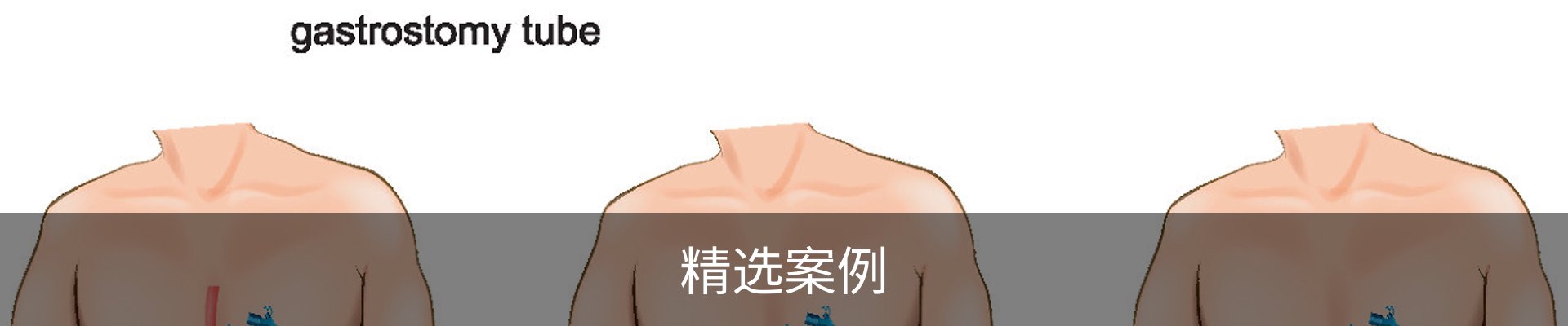 精选案例